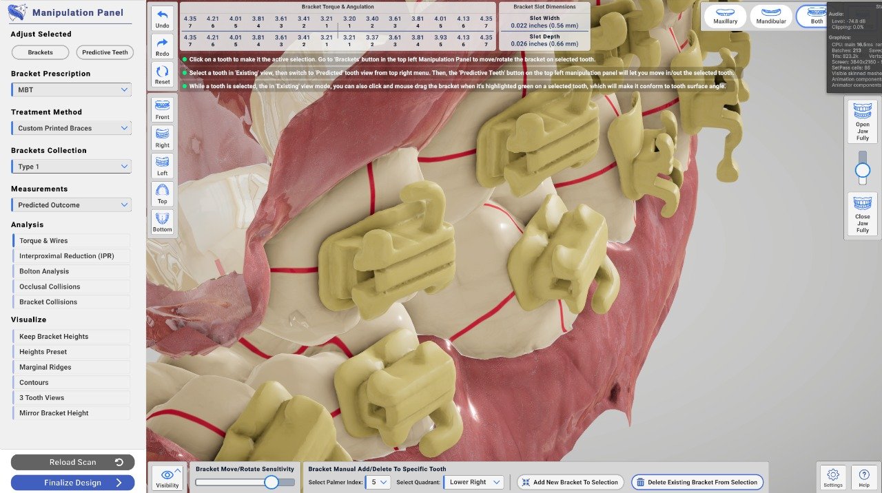 BraceFlow interface with individual bracket adjustment controls and a magnified dental arch