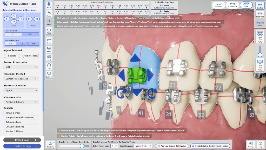 BraceFlow software showing metal brackets, individual movement controls, rotation controls and bracket slot dimensions